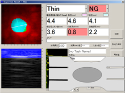自動計測結果 thin HG